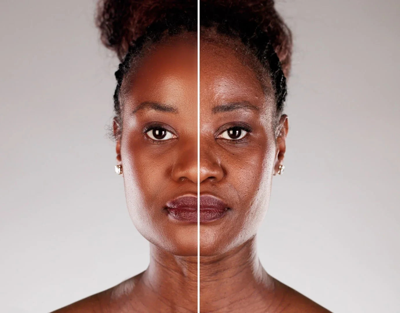 Understanding Aging Skin